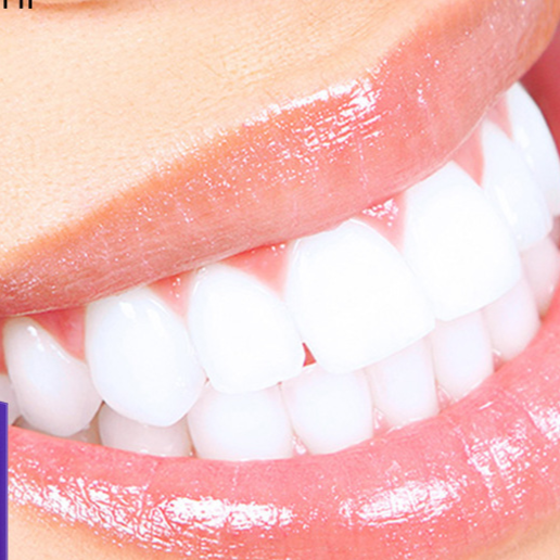 Teeth Whitening Paste